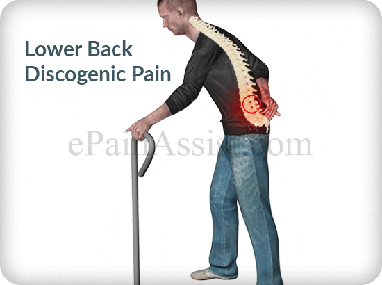 Physiotherapy in Dubai: Best treatment for sciatica pain