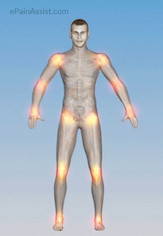 graphics showing possible parts in the body where inflammation may occur