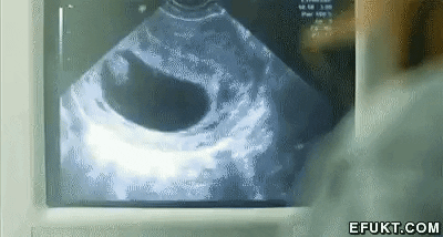 https://media.giphy.com/media/yLulXs8sgdq24/giphy.gif