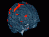 Mri GIF - Find & Share on GIPHY